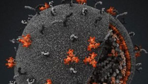 اكتشاف البروتينات التي تساعد فيروس نقص المناعة بالتوغل في خلايا الجسم