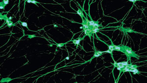 علماء يكتشفون خلايا مخ جديدة غريبة الشكل